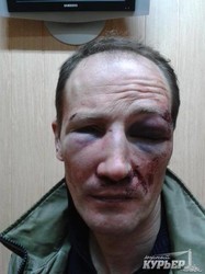 Одесского профессора-историка жестоко избили и ограбили (ФОТО)