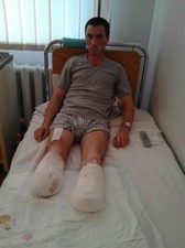 Раненому бойцу АТО из Одесской области необходима помощь