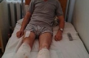 Раненому бойцу АТО из Одесской области необходима помощь