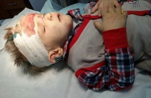 В Одессе отыскали родителей побитого и выброшенного на улицу мальчика