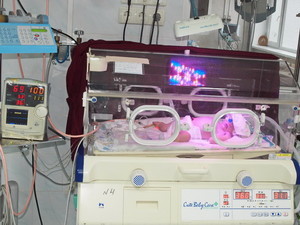Недоношенные младенцы в Одесской области могут не выжить из-за отсутствия дорогостоящего препарата