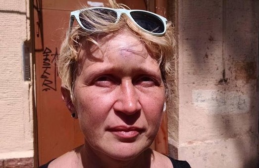 Одесскую журналистку, эколога и участника "группы 2 мая" избили