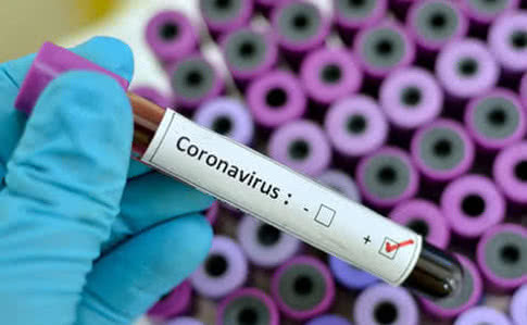 Экспресс-тесты для диагностики коронавируса обойдутся одесской «инфекционке» в 3,25 миллиона
