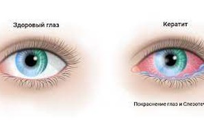 Институт Филатова в Одессе: На фоне стресса у детей обостряются болезни глаз